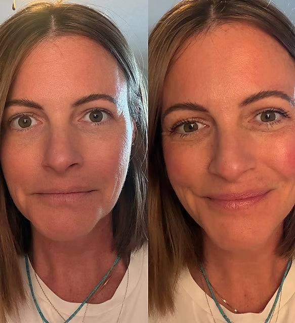Bitty Balm before and after